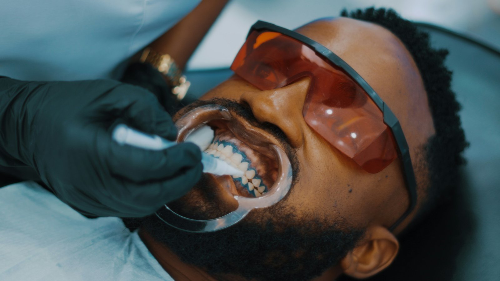 Adult orthodontic treatment